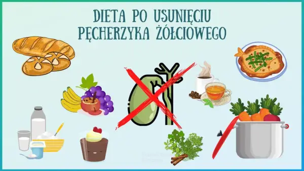 Zdrowe jedzenie po usunięciu woreczka żółciowego: pieczywo, owoce, nabiał, ryba, warzywa. Unikaj kawy i słodkości.